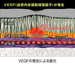 VEGFの発生による変化